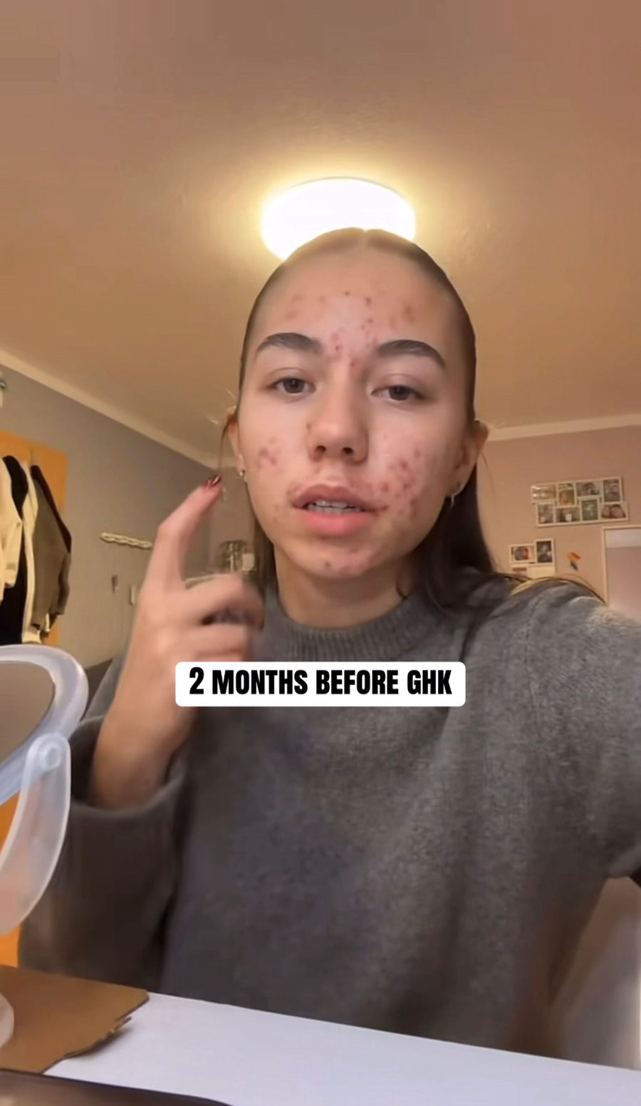 Before transformation 2